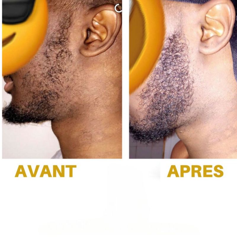 Accélérateur de pousse pour barbe : huiles 100% naturelles -D'OZE